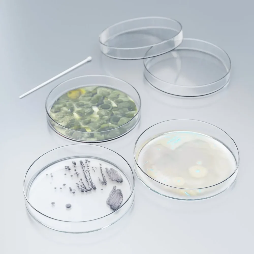 Petri Dishes With Bacteria Mold